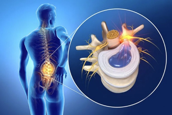 保护腰椎，正确的坐姿与环境：是打造坚固的外部防线