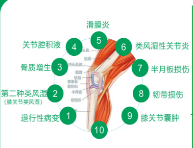 杭州余杭膝关节中医治疗好还是选择西医手术治疗